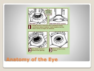 Anatomy of the Eye
 
