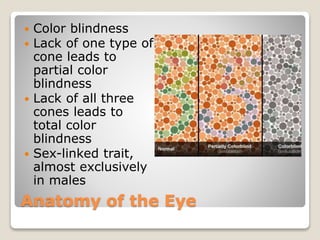 Anatomy of the Eye
 Color blindness
 Lack of one type of
cone leads to
partial color
blindness
 Lack of all three
cones leads to
total color
blindness
 Sex-linked trait,
almost exclusively
in males
 