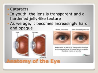 Anatomy of the Eye
 Cataracts
 In youth, the lens is transparent and a
hardened jelly-like texture
 As we age, it becomes increasingly hard
and opaque
 