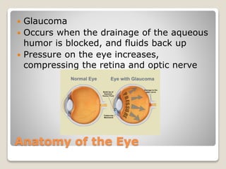 Anatomy of the Eye
 Glaucoma
 Occurs when the drainage of the aqueous
humor is blocked, and fluids back up
 Pressure on the eye increases,
compressing the retina and optic nerve
 