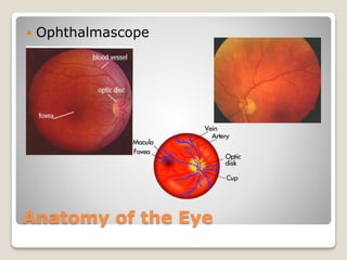 Anatomy of the Eye
 Ophthalmascope
 