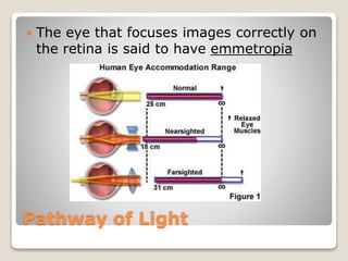Pathway of Light
 The eye that focuses images correctly on
the retina is said to have emmetropia
 