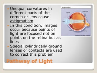 Pathway of Light
 Unequal curvatures in
different parts of the
cornea or lens cause
astigmatism
 In this condition, images
occur because points of
light are focused not on
points on the retina but as
lines
 Special cylindrically ground
lenses or contacts are used
to correct this problem
 
