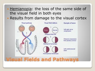 Visual Fields and Pathways
 Hemianopia: the loss of the same side of
the visual field in both eyes
 Results from damage to the visual cortex
 