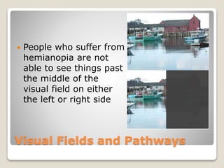 Visual Fields and Pathways
 People who suffer from
hemianopia are not
able to see things past
the middle of the
visual field on either
the left or right side
 