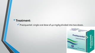 •Treatment:
✓Praziquantel: single oral dose of 40 mg/kg divided into two doses.
 