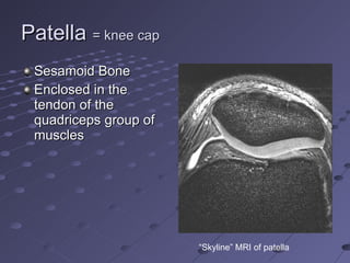 Patella  = knee cap Sesamoid Bone Enclosed in the tendon of the quadriceps group of muscles “ Skyline” MRI of patella 