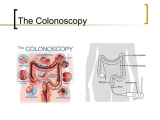 The Colonoscopy
 
