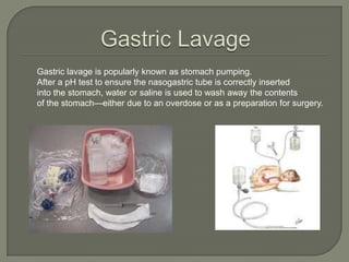 Gastric LavageGastric lavage is popularly known as stomach pumping.  After a pH test to ensure the nasogastric tube is correctly insertedinto the stomach, water or saline is used to wash away the contentsof the stomach—either due to an overdose or as a preparation for surgery.