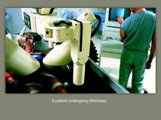 A patient undergoing lithotripsy