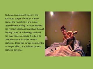 Cachexia is commonly seen in theadvanced stages of cancer.  Cancercauses the muscle loss and is notcaused by not eating.  Cancer patientscan receive additional nutrition throughfeeding tubes or IV feedings and stillcan experience cachexia. It is best totreat the cancer in order to treatcachexia.  Once the cancer treatment isno longer effect, it is difficult to treatcachexia directly.