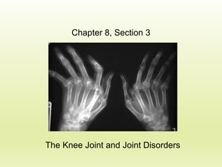 Chapter 8, Section 3

The Knee Joint and Joint Disorders

 