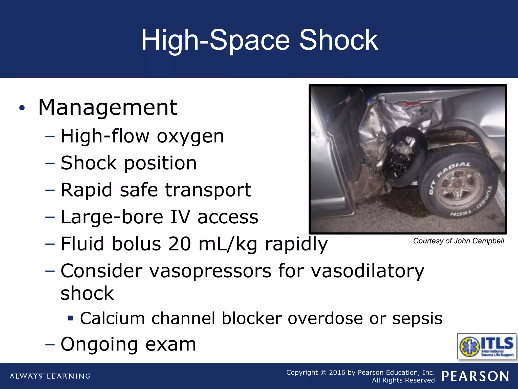 Copyright © 2016 by Pearson Education, Inc.
All Rights Reserved
High-Space Shock
• Management
– High-flow oxygen
– Shock position
– Rapid safe transport
– Large-bore IV access
– Fluid bolus 20 mL/kg rapidly
– Consider vasopressors for vasodilatory
shock
 Calcium channel blocker overdose or sepsis
– Ongoing exam
Courtesy of John Campbell
 