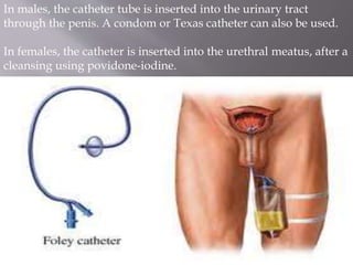 In males, the catheter tube is inserted into the urinary tract
through the penis. A condom or Texas catheter can also be used.
In females, the catheter is inserted into the urethral meatus, after a
cleansing using povidone-iodine.
 