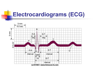 Electrocardiograms (ECG) 