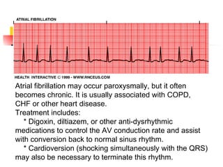 Atrial fibrillation may occur paroxysmally, but it often becomes chronic. It is usually associated with COPD, CHF or other heart disease. Treatment includes: * Digoxin, diltiazem, or other anti-dysrhythmic medications to control the AV conduction rate and assist with conversion back to normal sinus rhythm. * Cardioversion (shocking simultaneously with the QRS) may also be necessary to terminate this rhythm. 