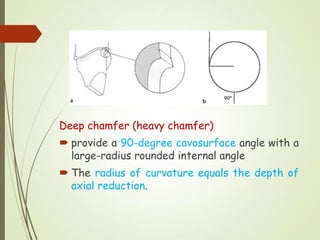 Chapter 9 part 2 Fixed prosthodontics shillinburg | PDF