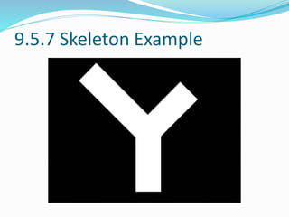 9.5.7 Skeleton Example
 