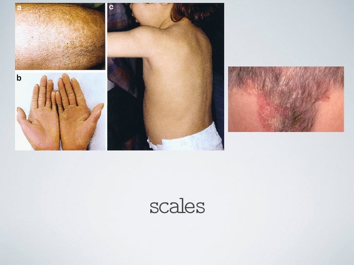 Chapter 9 Skin Disorders