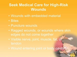 Seek Medical Care for High-Risk
Wounds
• Wounds with embedded material
• Bites
• Puncture wounds
• Ragged wounds, or wounds where skin
edges do not come together
• Visible nerve, joint, muscle, fat, or
tendon
• Wound entering joint or body cavity
 