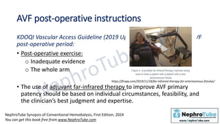 Hemodialysis: Chapter 9, Arteriovenous Fistula and Graft: Basics ...