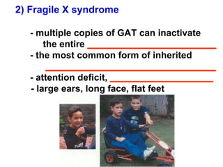 2) Fragile X syndrome - multiple copies of GAT can inactivate    the entire  _________________________ - the most common form of inherited   _________________________________ - attention deficit,  ____________________ - large ears, long face, flat feet 