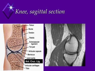 Knee, sagittal section Ant. Cruc. Lig. 