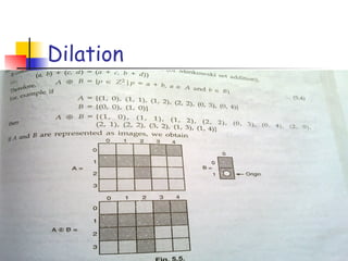 Dilation
19
 