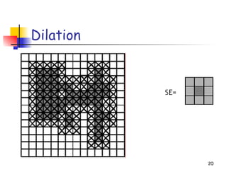 Dilation
20
 