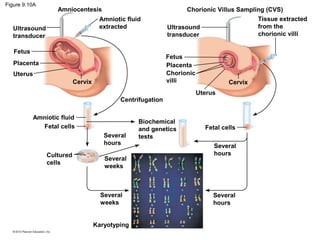 Figure 9.10A

Amniocentesis

Chorionic Villus Sampling (CVS)

Amniotic fluid
extracted

Ultrasound
transducer
Fetus

Ultrasound
transducer
Fetus
Placenta
Chorionic
villi

Placenta
Uterus
Cervix
Centrifugation
Amniotic fluid
Fetal cells
Several
hours
Cultured
cells

Tissue extracted
from the
chorionic villi

Several
weeks

Several
weeks
Karyotyping

Biochemical
and genetics
tests

Cervix
Uterus

Fetal cells
Several
hours

Several
hours

 