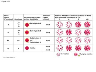 Figure 9.12

Blood
Group
(Phenotype)

Genotypes

Carbohydrates Present
on Red Blood Cells

A

IAIA
or
IAi

Carbohydrate A

Reaction When Blood from Groups Below Is Mixed
with Antibodies from Groups at Left
O
A
B
AB

Carbohydrate B

B

IBIB
or
IBi

Antibodies
Present
in Blood

AB

O

IAIB

ii

Anti-B

Anti-A

Carbohydrate A
and
Carbohydrate B

Neither

None

Anti-A
Anti-B
No reaction

Clumping reaction

 