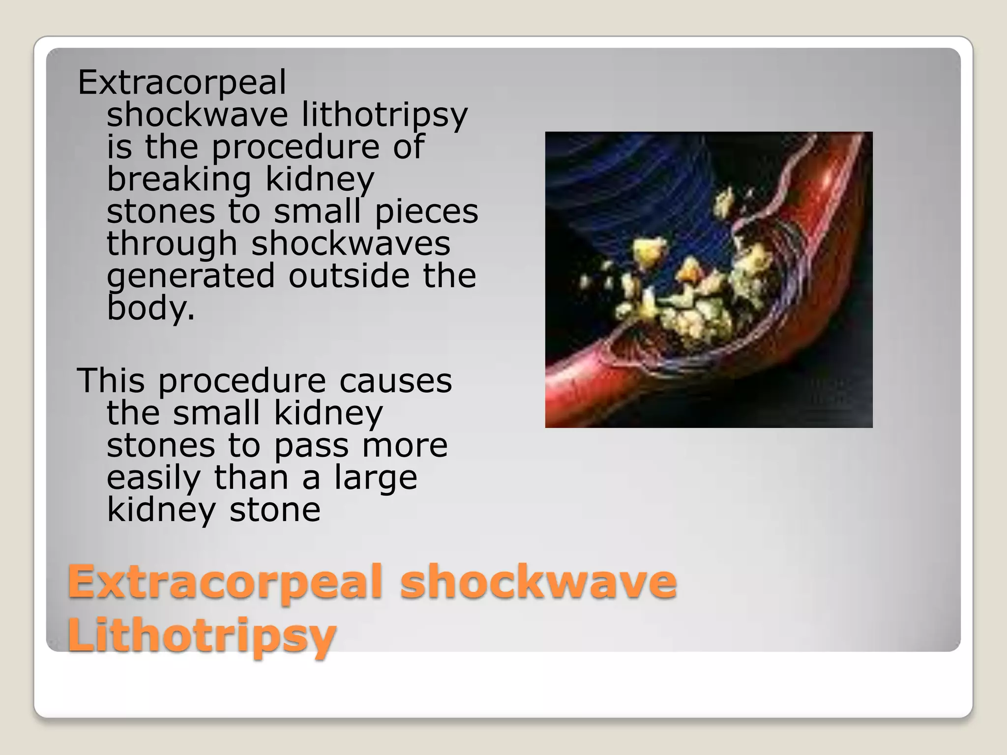 Intermittent Catheter