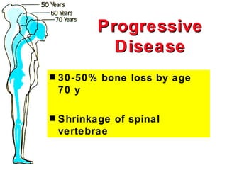 Progressive
             Disease
s   30-50% bone loss by age
    70 y

s   Shrinkage of spinal
    vertebrae
 