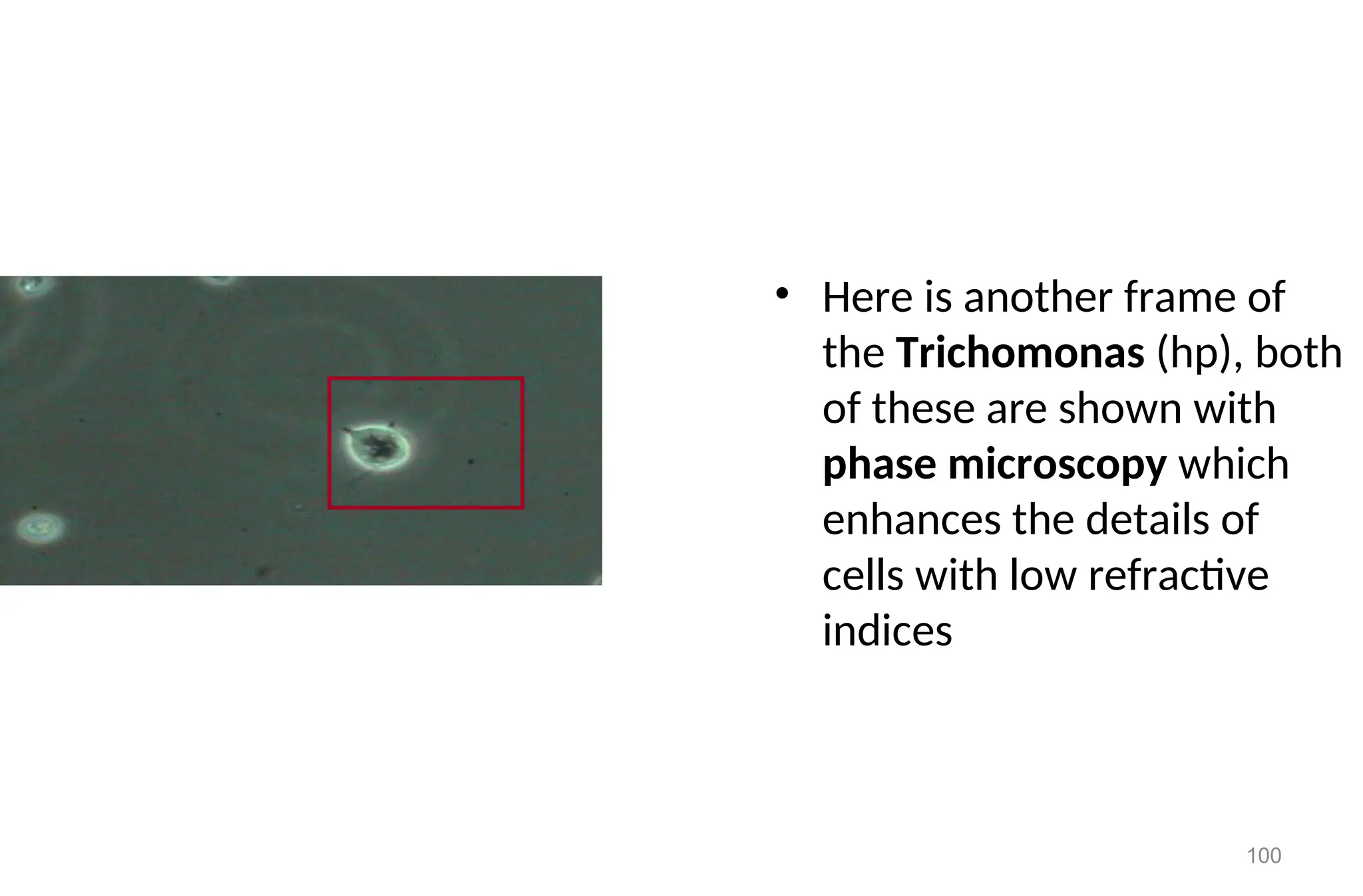 100
• Here is another frame of
the Trichomonas (hp), both
of these are shown with
phase microscopy which
enhances the details of
cells with low refractive
indices
 