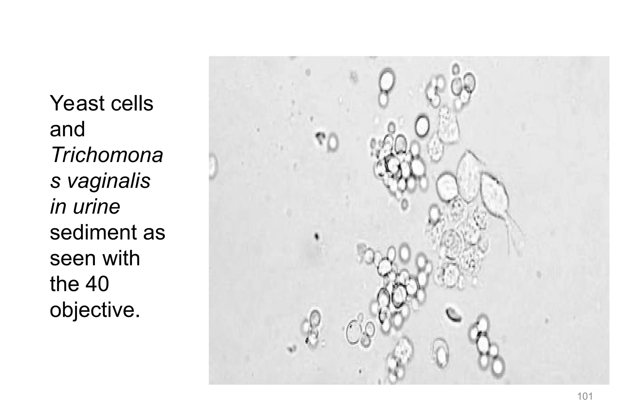 101
Yeast cells
and
Trichomona
s vaginalis
in urine
sediment as
seen with
the 40
objective.
 