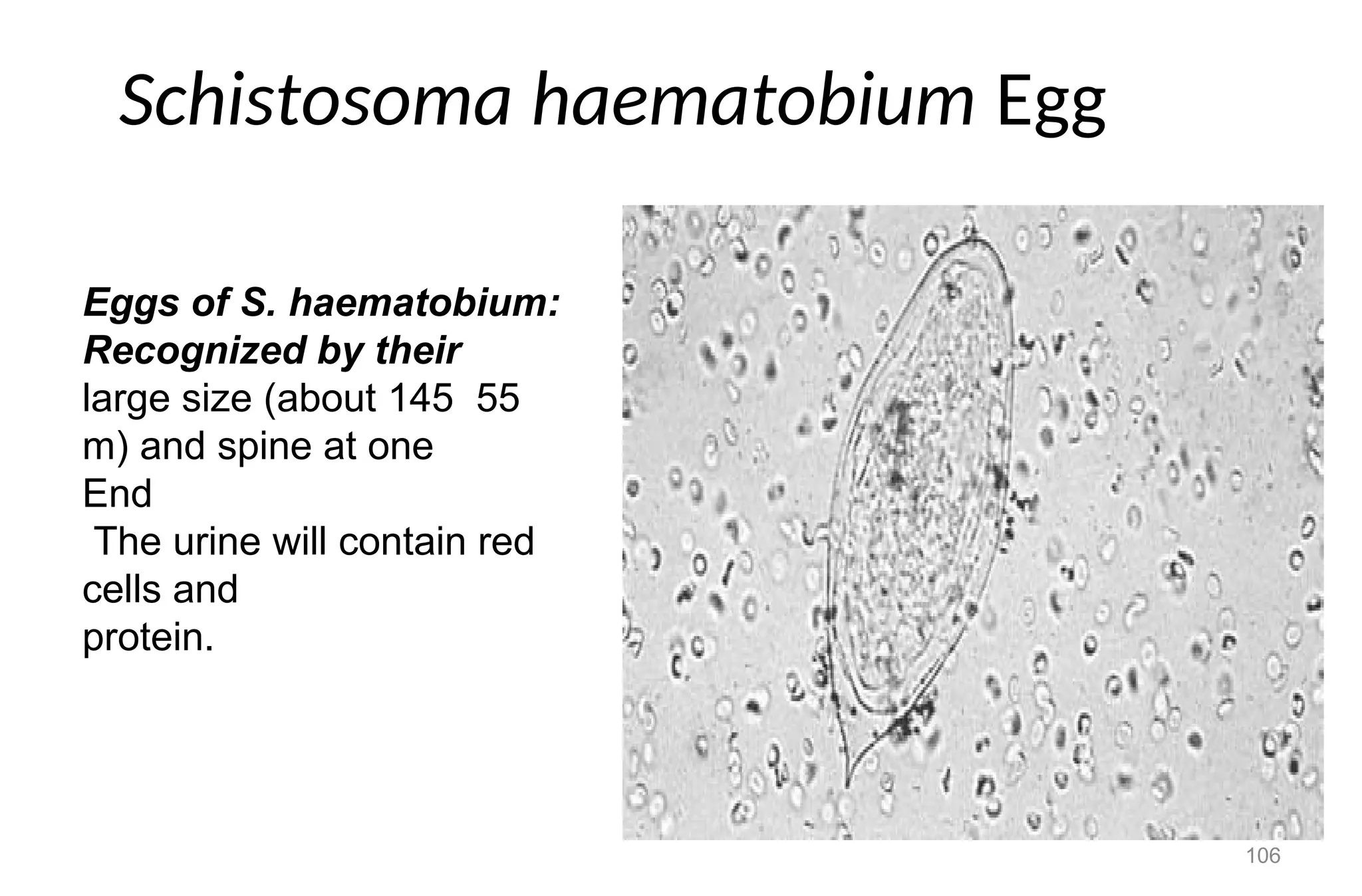 106
Schistosoma haematobium Egg
Eggs of S. haematobium:
Recognized by their
large size (about 145 55
m) and spine at one
End
The urine will contain red
cells and
protein.
 