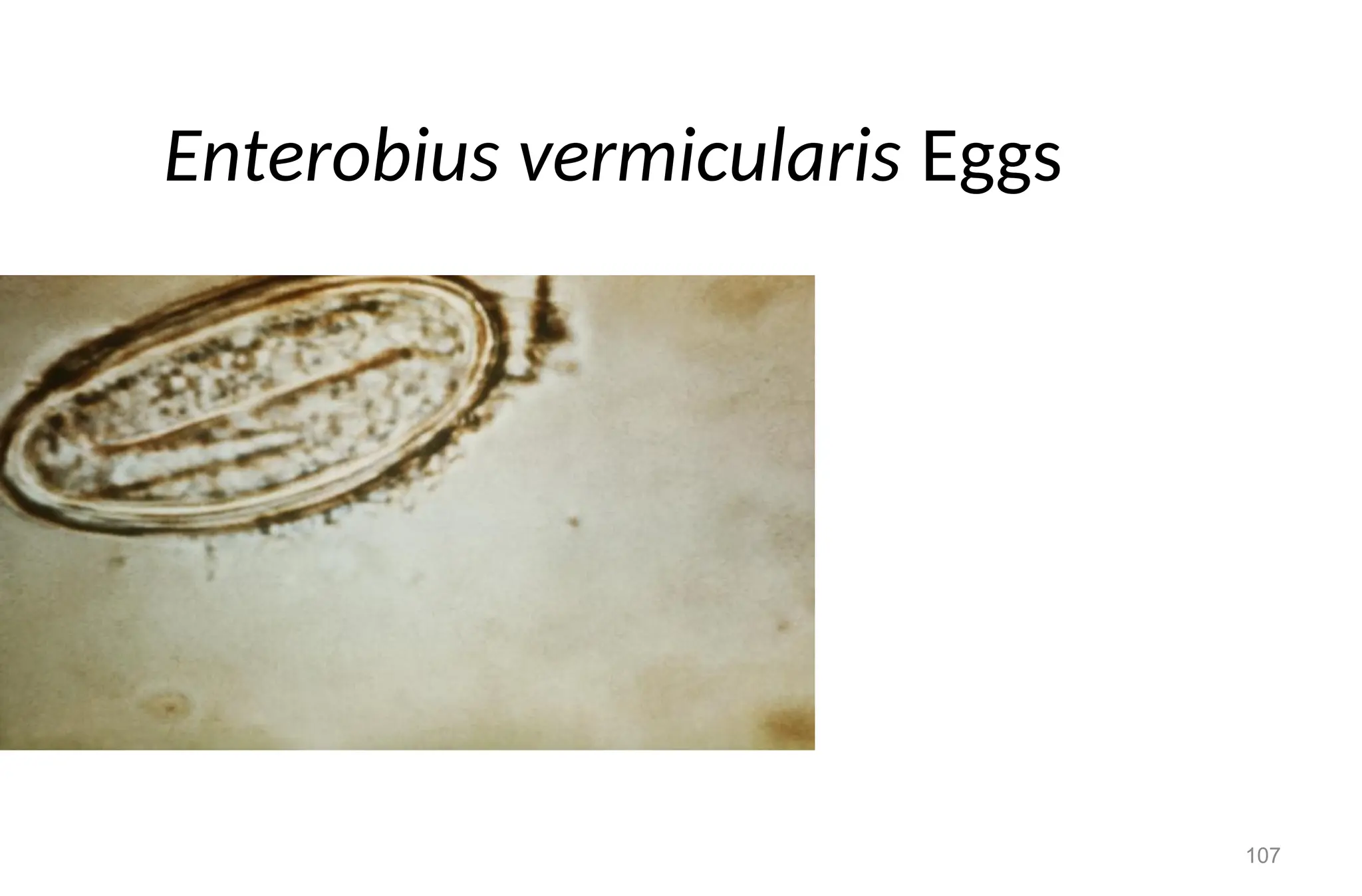 107
Enterobius vermicularis Eggs
 