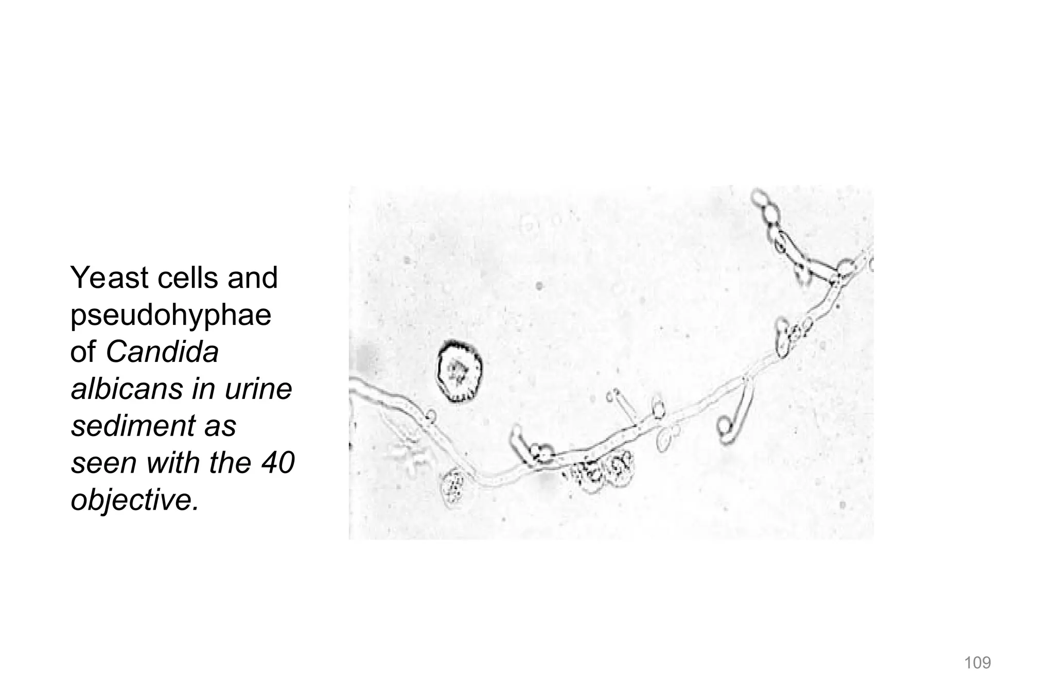 109
Yeast cells and
pseudohyphae
of Candida
albicans in urine
sediment as
seen with the 40
objective.
 