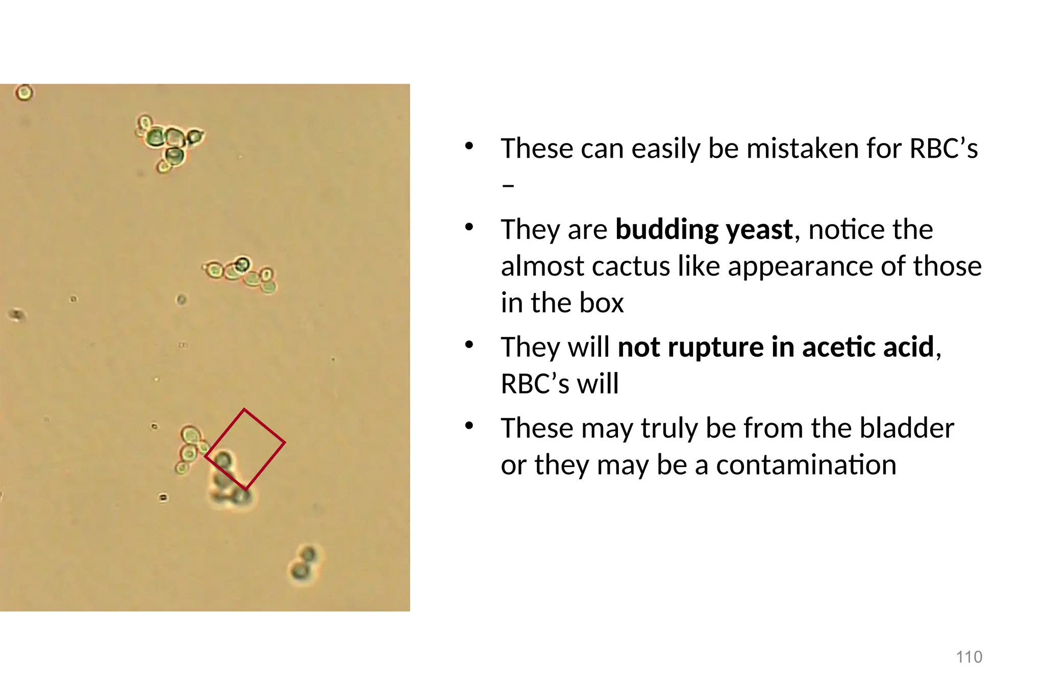 110
• These can easily be mistaken for RBC’s
–
• They are budding yeast, notice the
almost cactus like appearance of those
in the box
• They will not rupture in acetic acid,
RBC’s will
• These may truly be from the bladder
or they may be a contamination
 