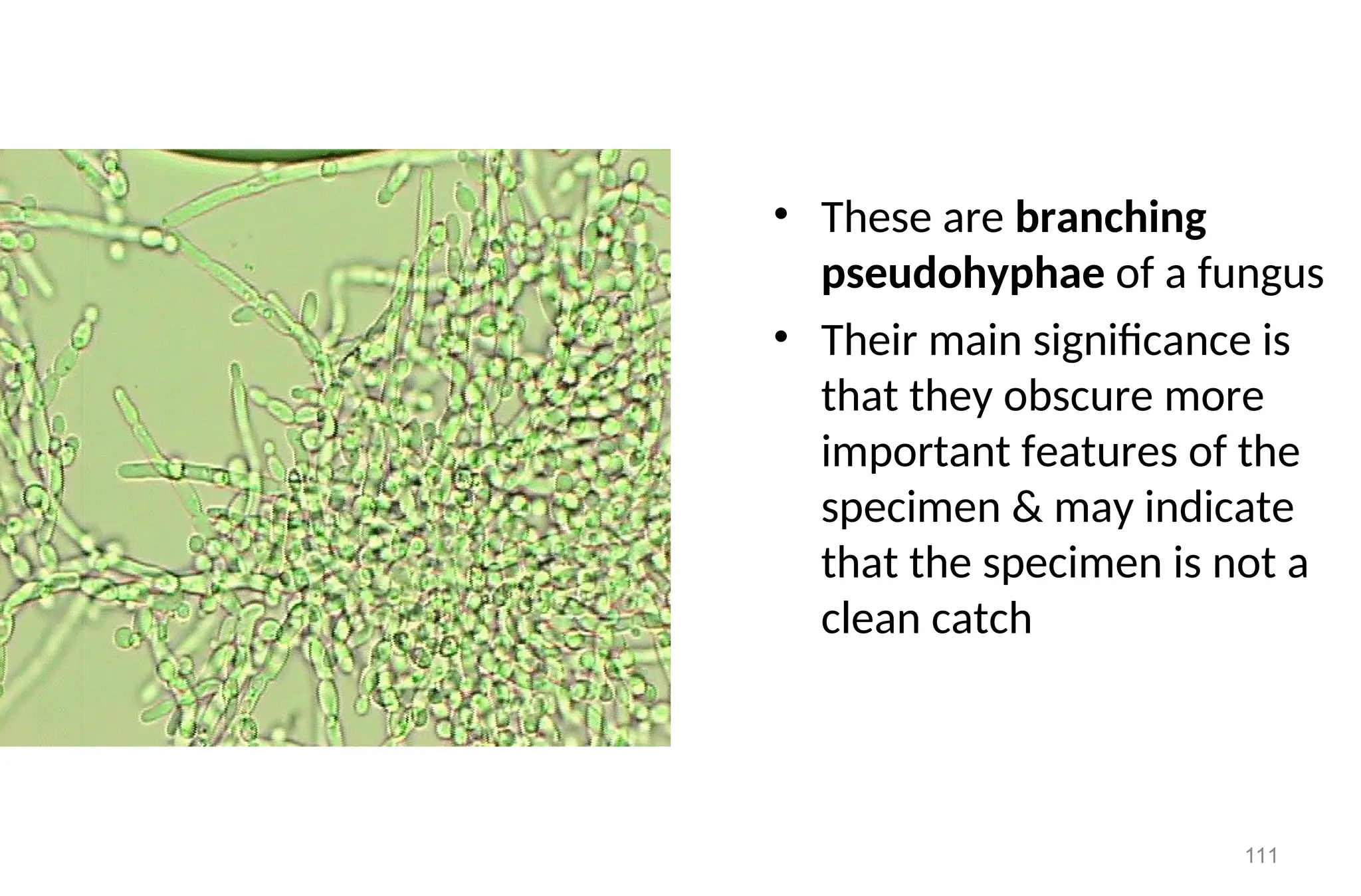 111
• These are branching
pseudohyphae of a fungus
• Their main significance is
that they obscure more
important features of the
specimen & may indicate
that the specimen is not a
clean catch
 