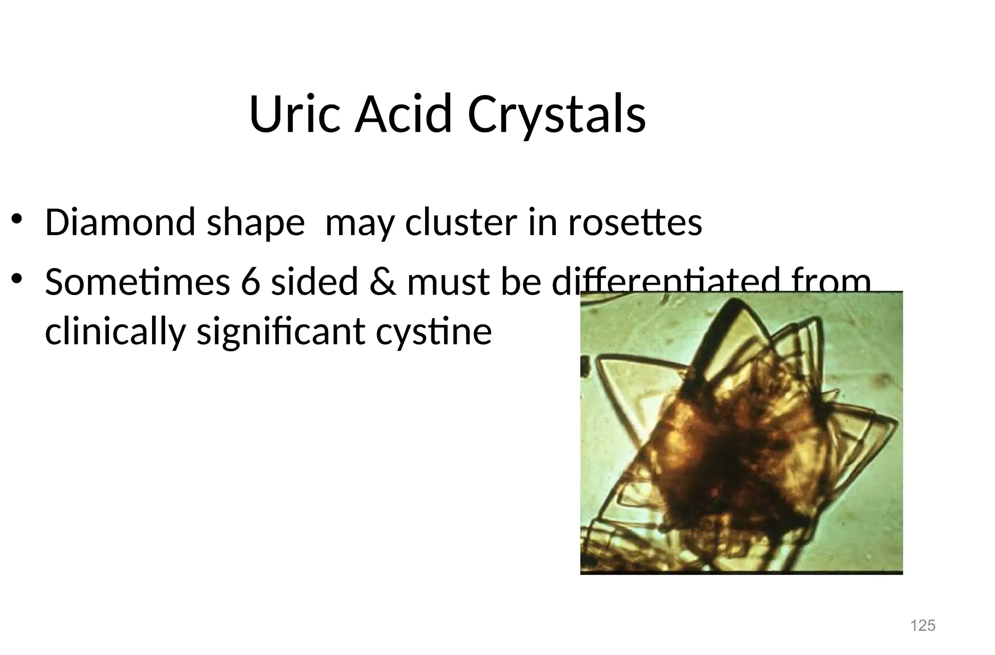 125
Uric Acid Crystals
• Diamond shape may cluster in rosettes
• Sometimes 6 sided & must be differentiated from
clinically significant cystine
 