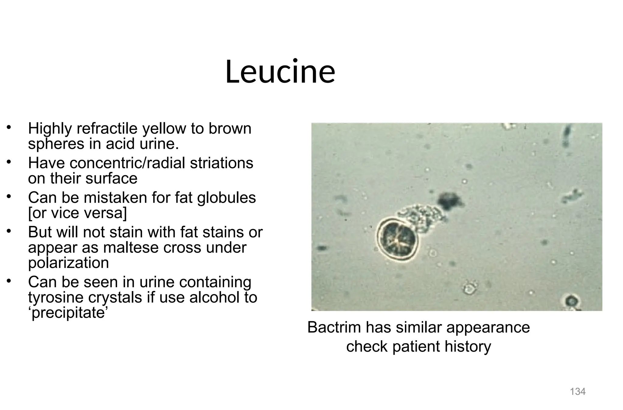 134
Leucine
• Highly refractile yellow to brown
spheres in acid urine.
• Have concentric/radial striations
on their surface
• Can be mistaken for fat globules
[or vice versa]
• But will not stain with fat stains or
appear as maltese cross under
polarization
• Can be seen in urine containing
tyrosine crystals if use alcohol to
‘precipitate’
Bactrim has similar appearance
check patient history
 