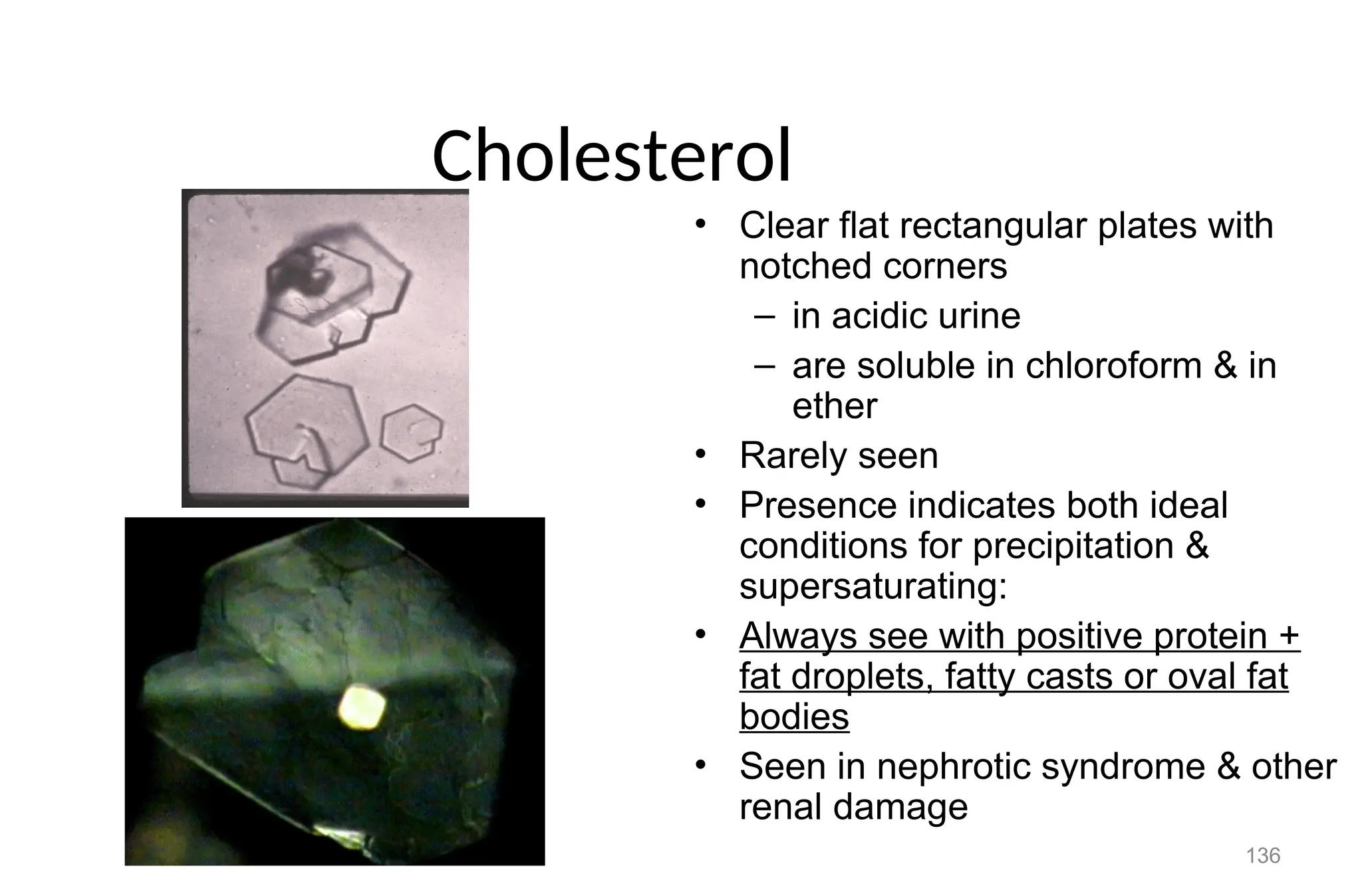 136
Cholesterol
• Clear flat rectangular plates with
notched corners
– in acidic urine
– are soluble in chloroform & in
ether
• Rarely seen
• Presence indicates both ideal
conditions for precipitation &
supersaturating:
• Always see with positive protein +
fat droplets, fatty casts or oval fat
bodies
• Seen in nephrotic syndrome & other
renal damage
 