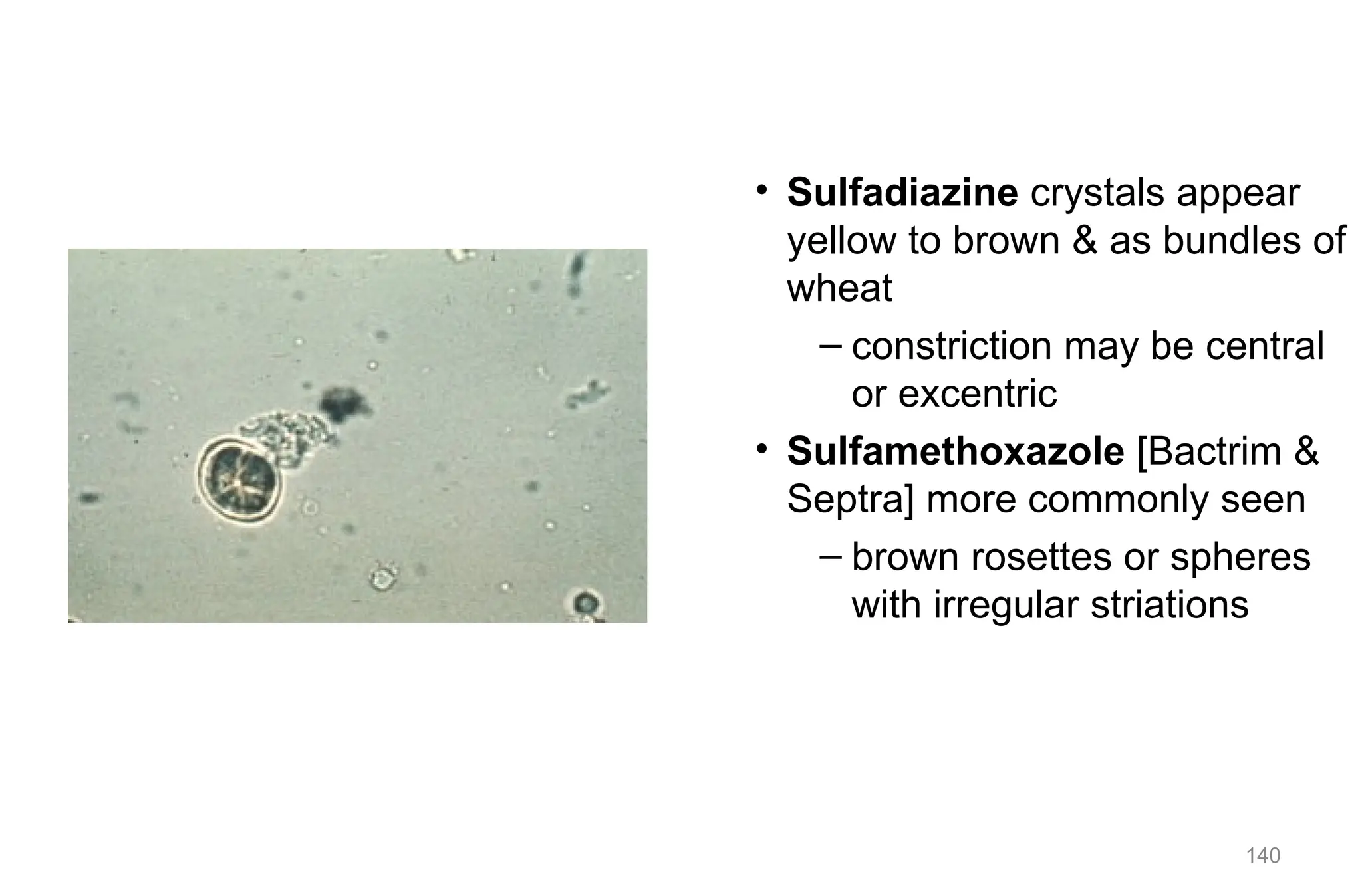140
• Sulfadiazine crystals appear
yellow to brown & as bundles of
wheat
– constriction may be central
or excentric
• Sulfamethoxazole [Bactrim &
Septra] more commonly seen
– brown rosettes or spheres
with irregular striations
 