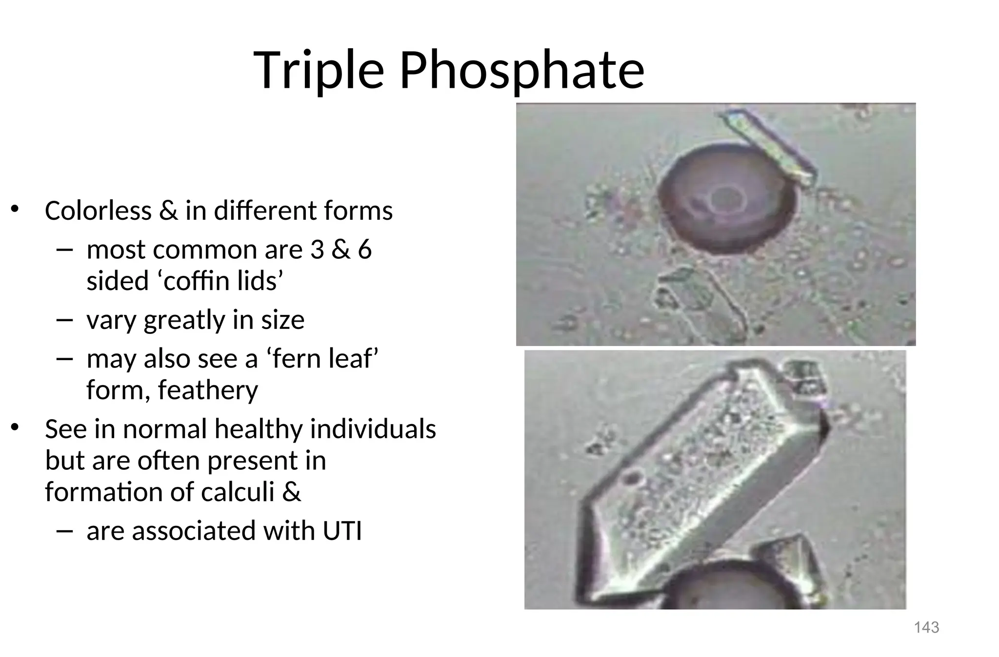143
Triple Phosphate
• Colorless & in different forms
– most common are 3 & 6
sided ‘coffin lids’
– vary greatly in size
– may also see a ‘fern leaf’
form, feathery
• See in normal healthy individuals
but are often present in
formation of calculi &
– are associated with UTI
 