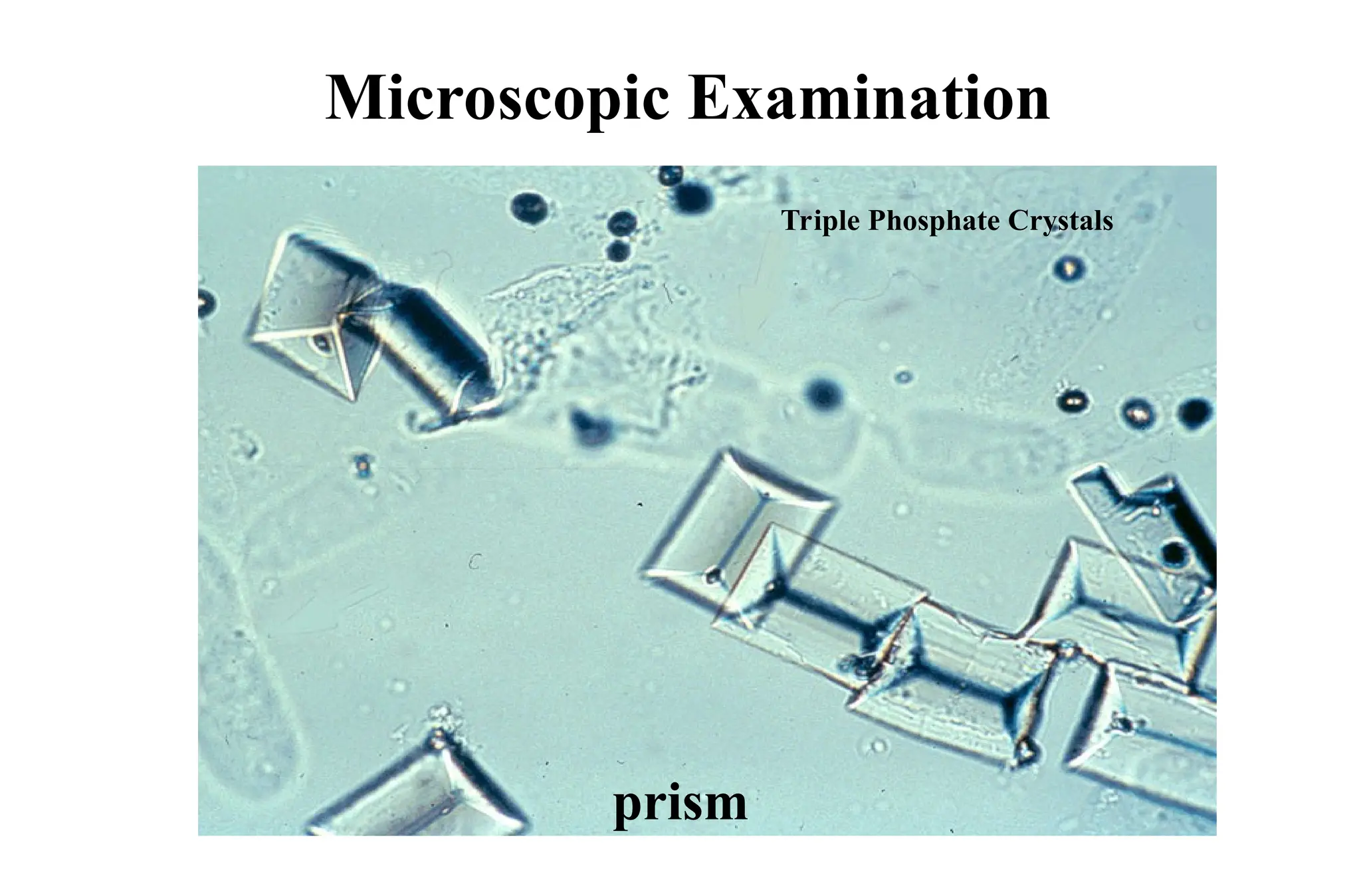 Microscopic Examination
Triple Phosphate Crystals
prism
 