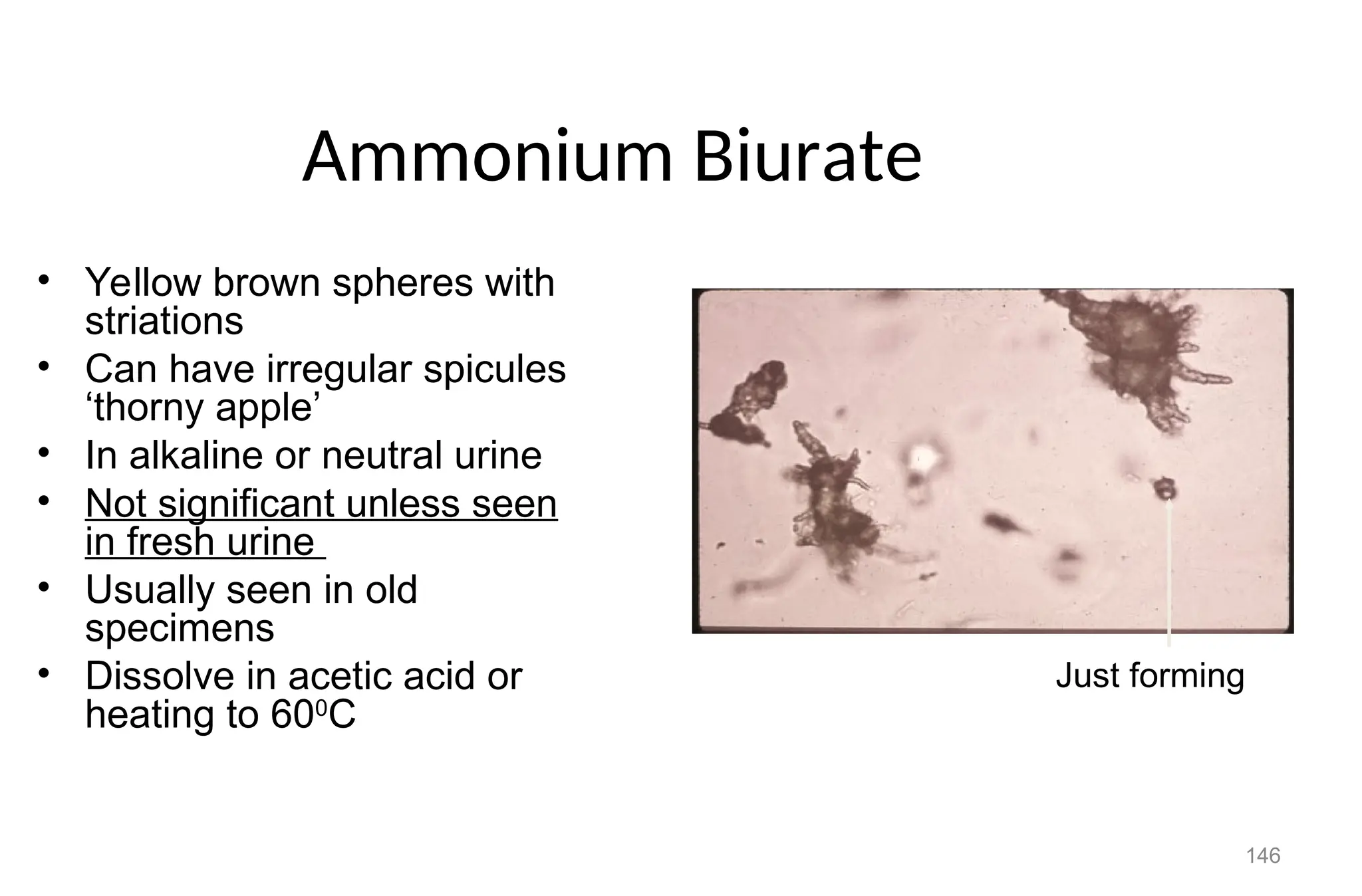 146
Ammonium Biurate
• Yellow brown spheres with
striations
• Can have irregular spicules
‘thorny apple’
• In alkaline or neutral urine
• Not significant unless seen
in fresh urine
• Usually seen in old
specimens
• Dissolve in acetic acid or
heating to 600
C
Just forming
 
