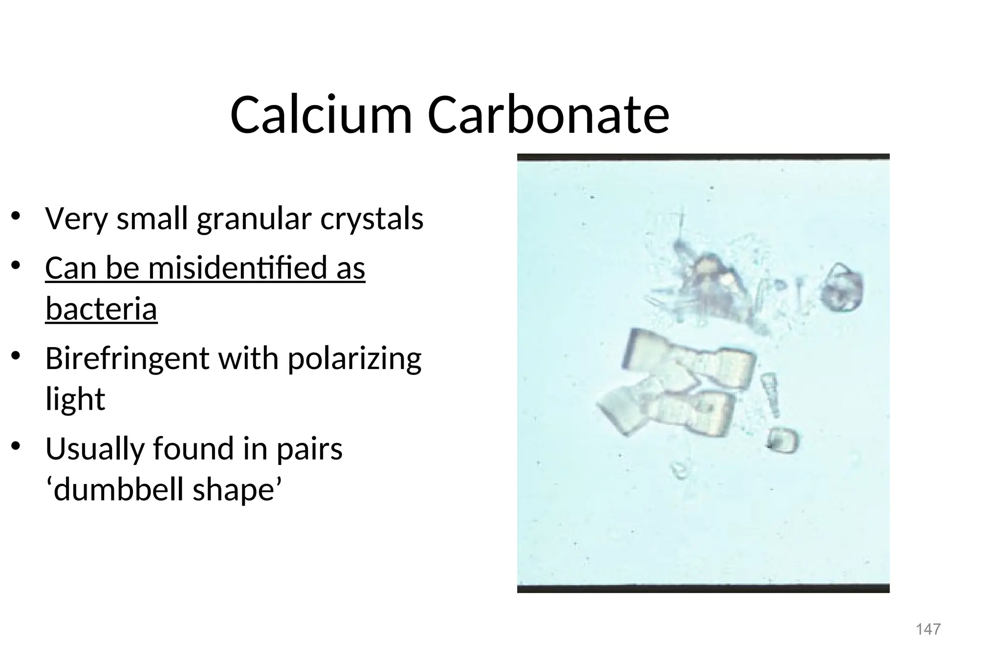 147
Calcium Carbonate
• Very small granular crystals
• Can be misidentified as
bacteria
• Birefringent with polarizing
light
• Usually found in pairs
‘dumbbell shape’
 