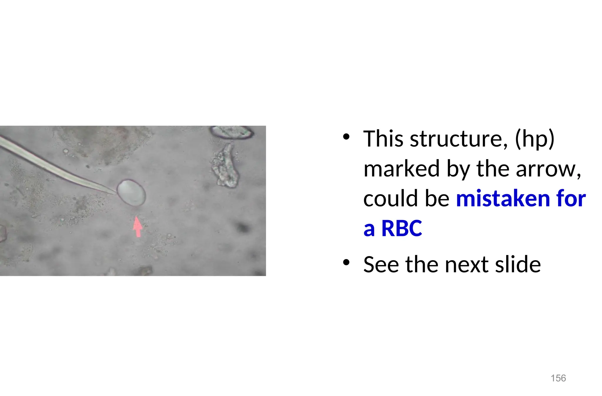 156
• This structure, (hp)
marked by the arrow,
could be mistaken for
a RBC
• See the next slide
 