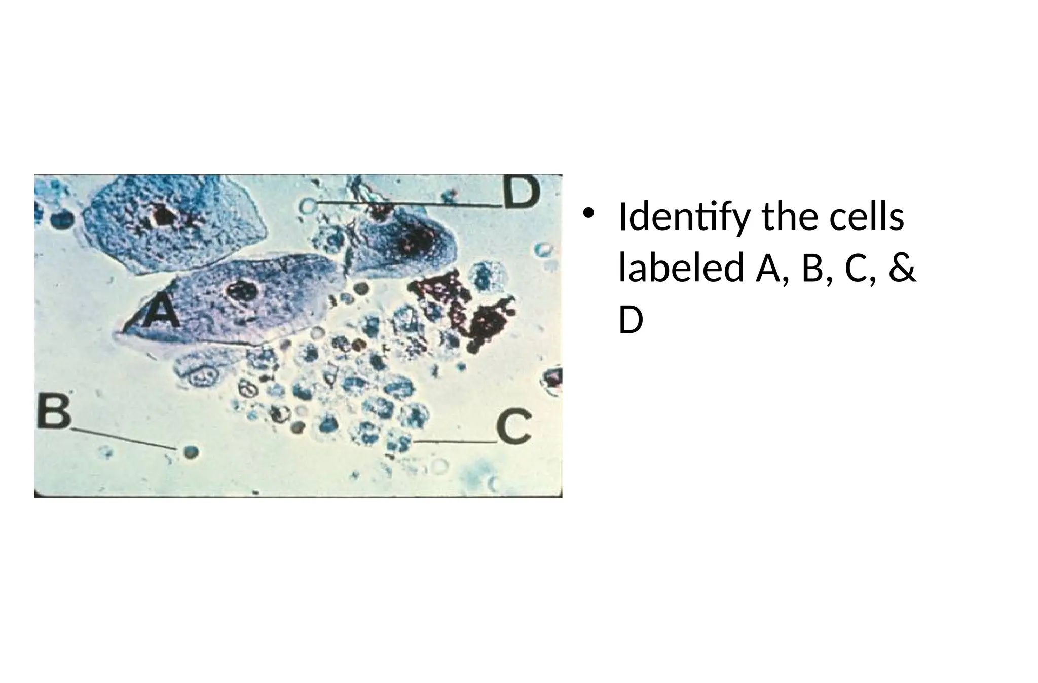 • Identify the cells
labeled A, B, C, &
D
 